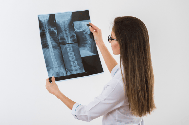 Whole Body Digital X-Ray